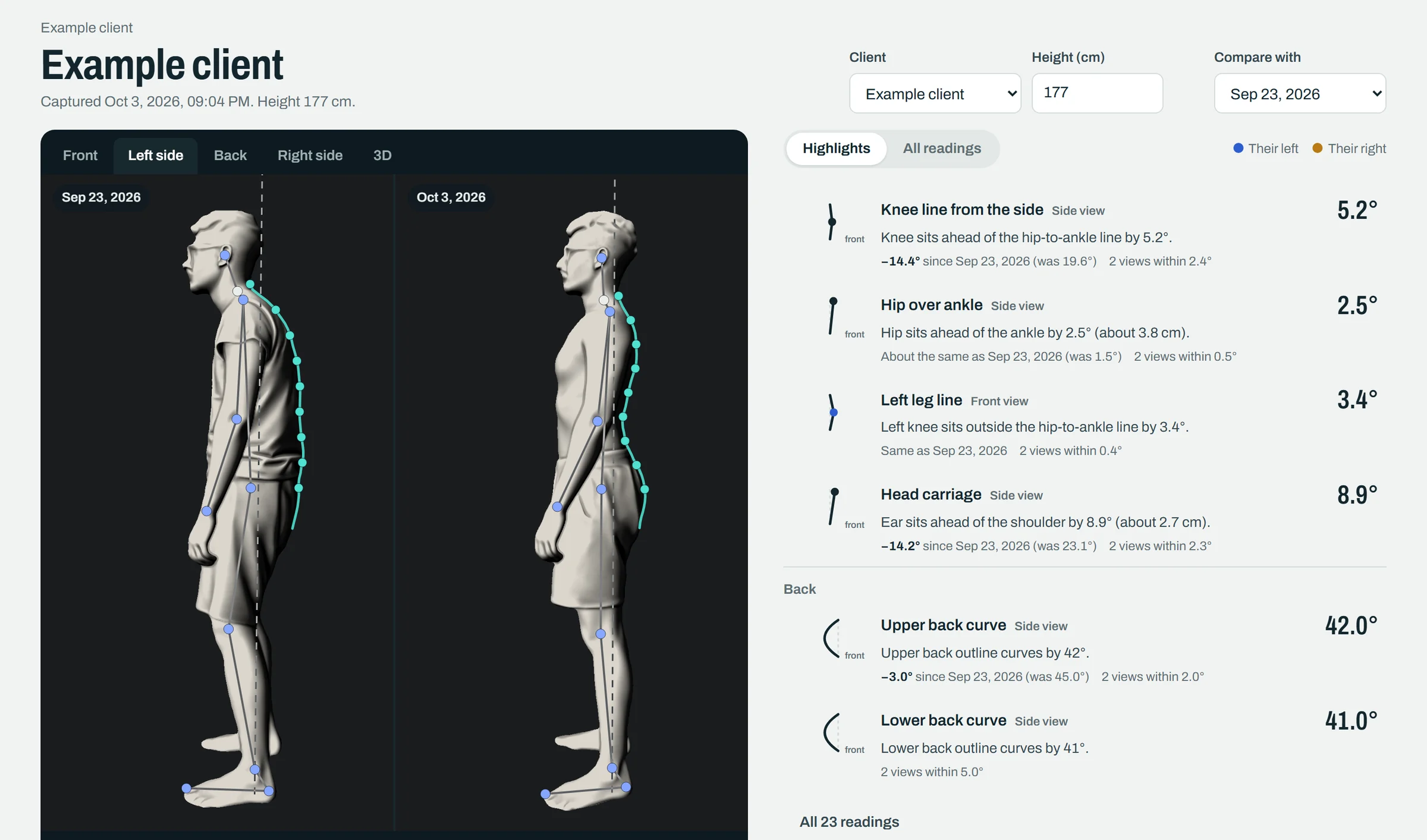 Truestance on a computer: one client from the side on two visits, as sculpted figures with the line of the back drawn in, beside readings such as knee line and head carriage and how each has changed
