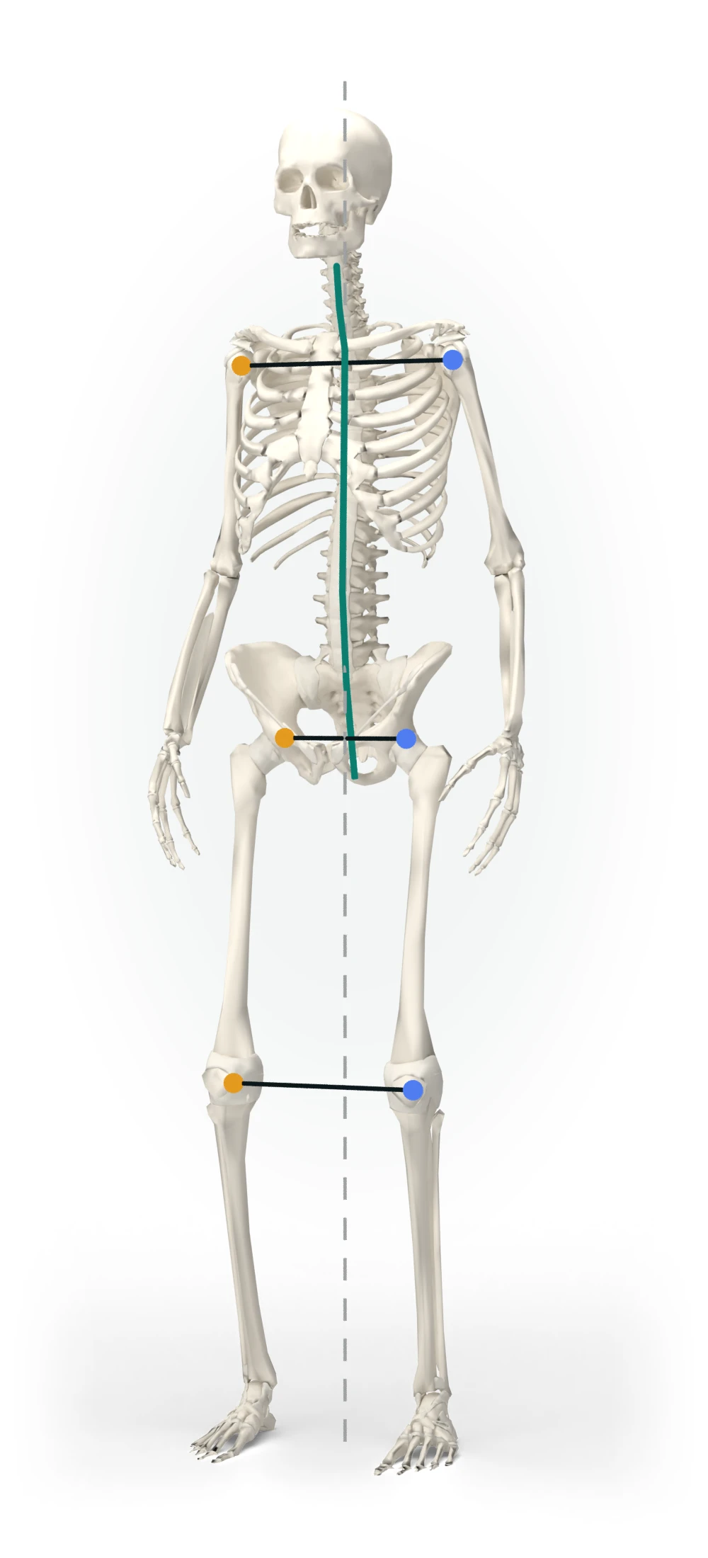 The 3D skeleton Truestance fits to a scan, with the lines a scan draws on it: a plumb line, the spine, and the level of the shoulders, hips and knees, the right side in amber and the left in blue