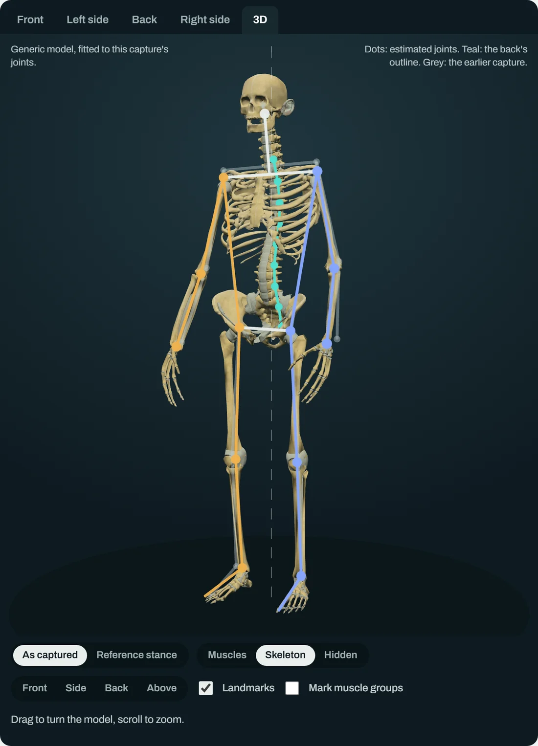 The 3D view in Truestance: a scan fitted to an anatomical model that can be turned, with the joints and the line of the spine marked, shown here as a skeleton